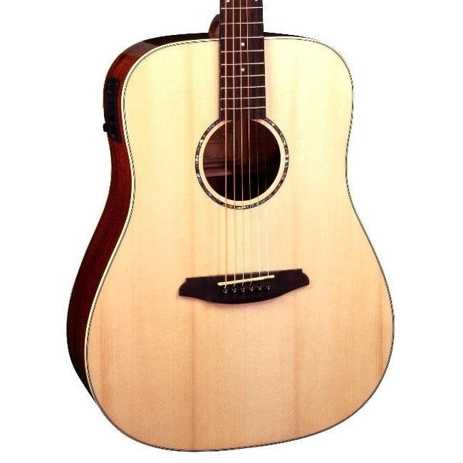 Rathbone R5SME akoestisch/elektrisch gitaar vooraanzicht body