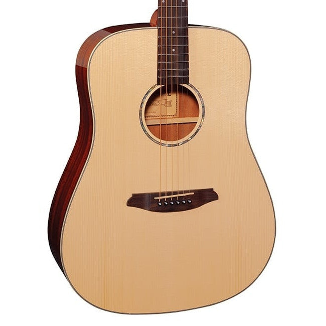 Rathbone R5SM akoestisch gitaar vooraanzicht body